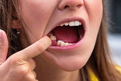 Woman with a missing tooth