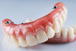 A pair of implant dentures
