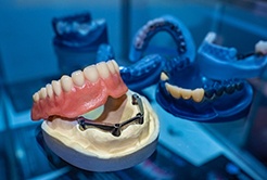 implant dentures on table 