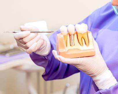 Dentist explaining dental implants, a treatment often involved in full mouth reconstruction