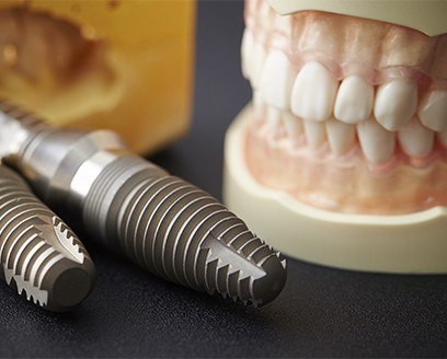 Model of the mouth next to a few dental implants on tray