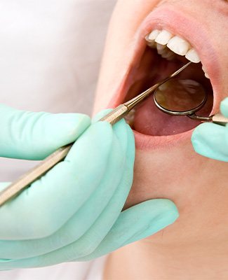 Closeup of dentist’s hands in green gloves examining woman’s mouth