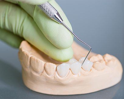 Gloved hand crafting a dental bridge