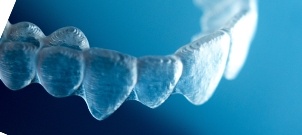 Close up of Invisalign aligner tray