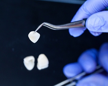 Dentist picking up a veneer with a dental instrument