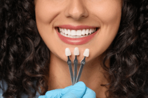 Dentist comparing dental veneer shades to a patient’s smile